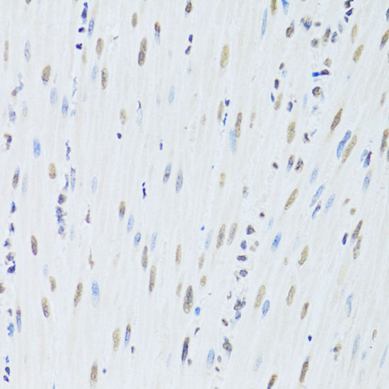 Immunohistochemistry of paraffin-embedded Mouse esophagus using HNRNPK Polyclonal Antibody at dilution of 1:200 (40x lens).