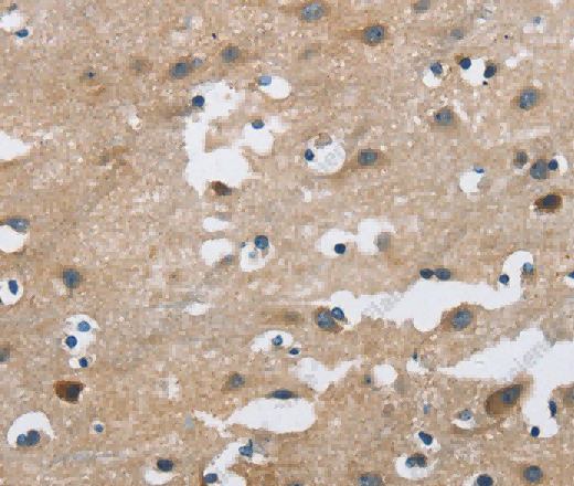 FGF9 Polyclonal Antibody - 3