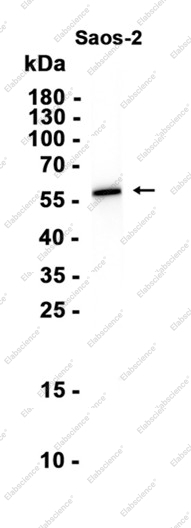 Recombinant Lumican Monoclonal Antibody - 3