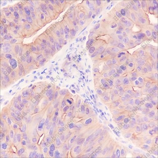 Recombinant IL-10 Monoclonal Antibody - 2