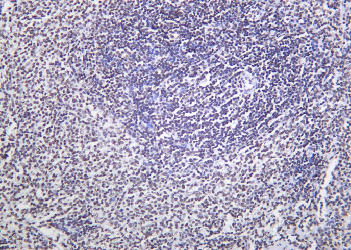 Recombinant Phospho-Rpb1 (Ser2) Monoclonal Antibody-searchlist-1