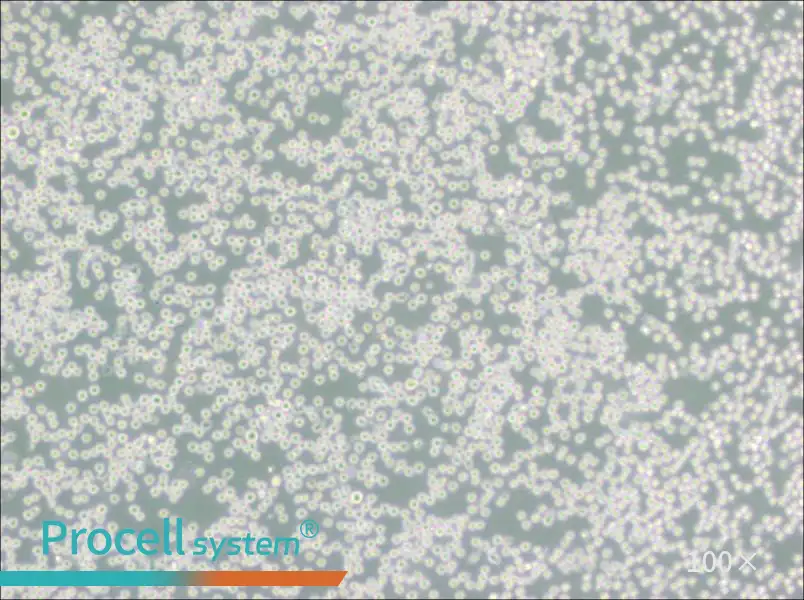 SU-DHL-4 Cell Complete MediumSU-DHL-4 Cell Complete Medium - 3