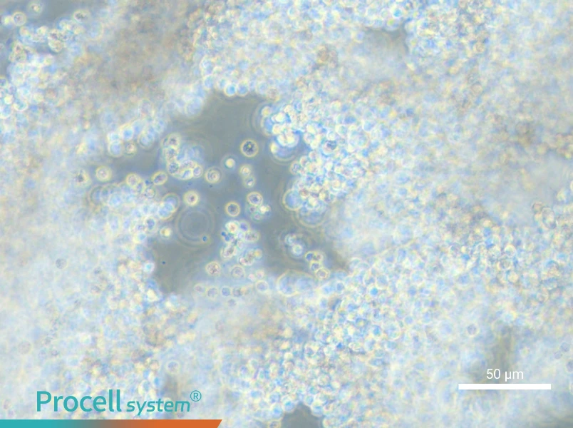 NCI-H2171 - 5