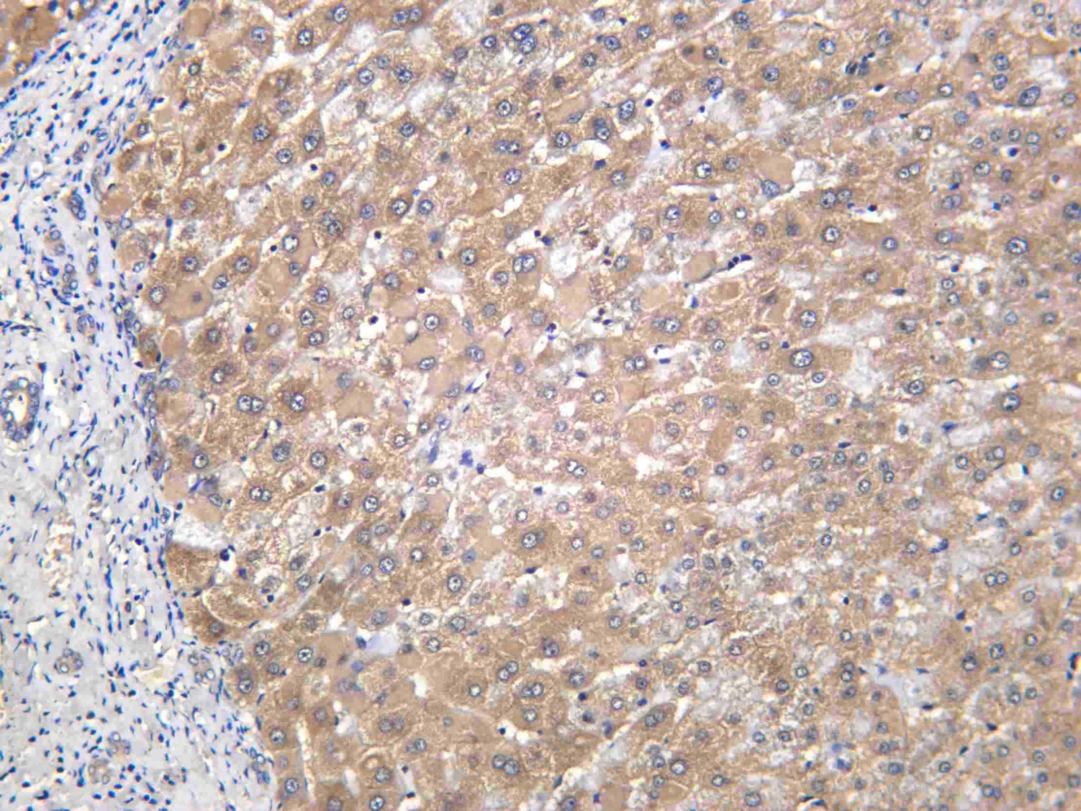 Recombinant L-Lactyl Lysine Monoclonal Antibody - 2