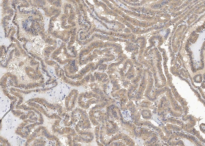 TROP2/TACSTD2 Monoclonal Antibody - small - 12