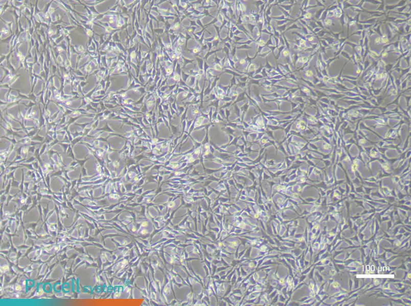 Rat Bone Marrow Mesenchymal Stem (Primary cell immortalization) Cell Complete Medium - 2