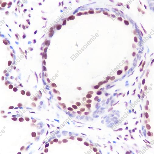 Recombinant Androgen Receptor (CT) Monoclonal Antibody - 2
