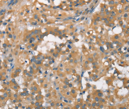 PLEKHO1 Polyclonal Antibody - 2