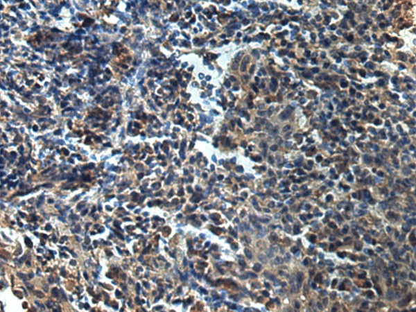 Immunohistochemistry of paraffin-embedded Human tonsil tissue  using ATP1B2 Polyclonal Antibody at dilution of 1:25(?200)