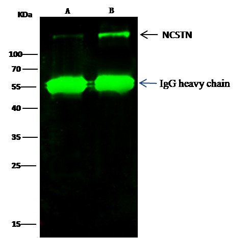 Recombinant Nicastrin/NCSTN Monoclonal Antibody - small - 2