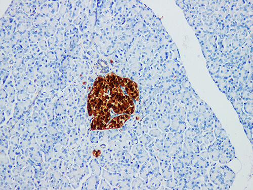 Immunohistochemistry of paraffinembedded Human pancreatic tissue with NSE Monoclonal Antibody(Antigen repaired by EDTA).