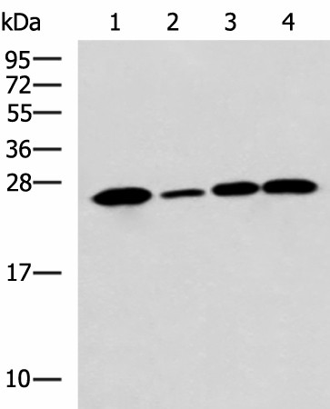 Western blot analysis of Human cerebrum tissue A172 cell Mouse brain tissue Rat brain tissue lysates  using UCHL1 Polyclonal Antibody at dilution of 1:900