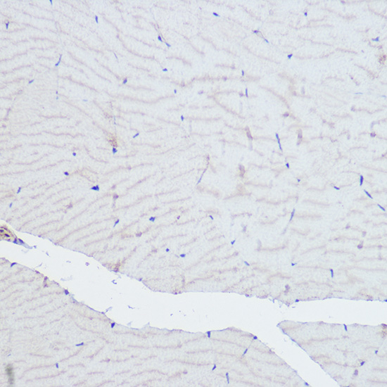 Immunohistochemistry of paraffin-embedded rat skeletal muscle using ACTN3 Polyclonal antibody at dilution of 1:500 (40x lens).Perform high pressure antigen retrieval with 10 mM citrate buffer pH 6.0 before commencing with IHC staining protocol.