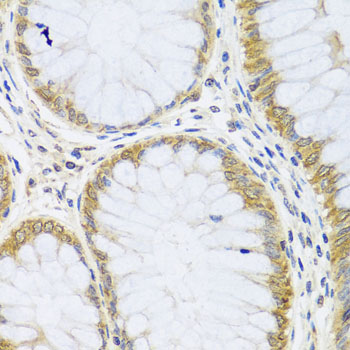 Immunohistochemistry of paraffin-embedded Human colon using ARL6 Polyclonal Antibody at dilution of  1:100 (40x lens).