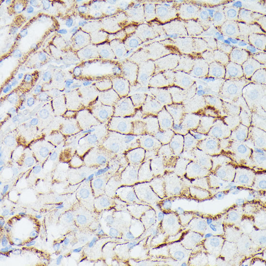 Immunohistochemistry of paraffin-embedded Mouse kidney using IFITM1 Polyclonal Antibody at dilution of 1:100 (40x lens).
