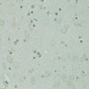 Immunohistochemistry of paraffin-embedded Rat brain using GTF2H2C Polyclonal Antibody at dilution of 1:100 (40x lens).