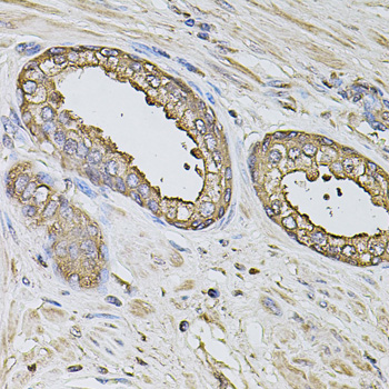 Immunohistochemistry of paraffin-embedded Human prostate using S100A12 Polyclonal Antibody at dilution of 1:100 (40x lens).