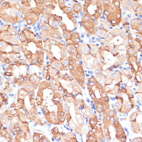 Immunohistochemistry of paraffin-embedded human stomach using NHLRC1 Polyclonal Antibody at dilution of 1:100 (40x lens).Perform microwave antigen retrieval with 10 mM PBS buffer pH 7.2 before commencing with IHC staining protocol.