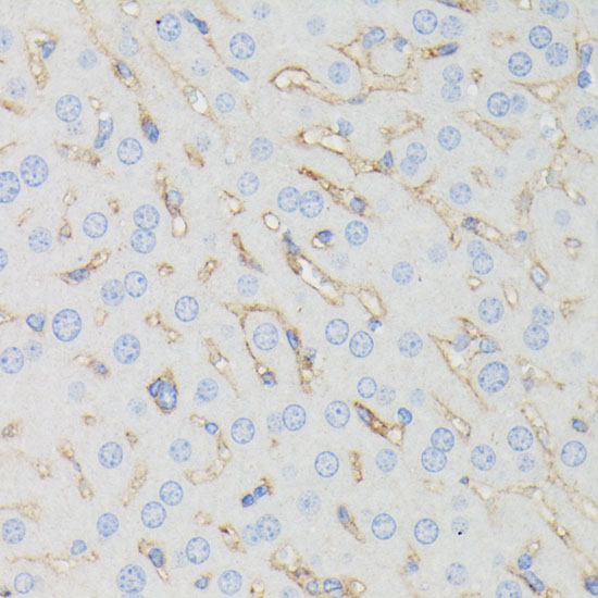 Immunohistochemistry of paraffin-embedded Mouse liver using IFITM1 Polyclonal Antibody at dilution of 1:100 (40x lens).