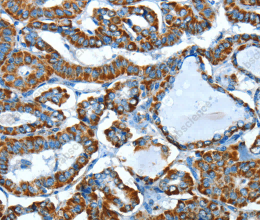 ALDH6A1 Polyclonal Antibody - 2