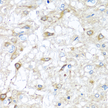Immunohistochemistry of paraffin-embedded Rat brain using RAC2 Polyclonal Antibody at dilution of 1:100 (40x lens).