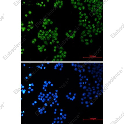 Recombinant SP1 Monoclonal Antibody - 2