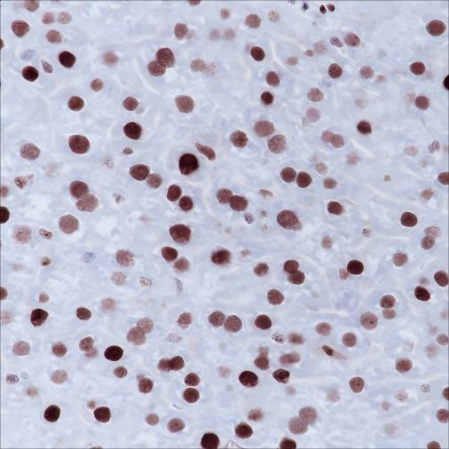 Recombinant MSH6 Monoclonal Antibody - small - 4