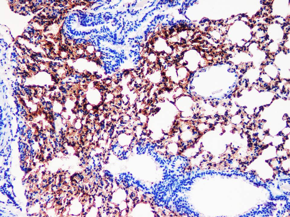 AGER Polyclonal antibody - 3