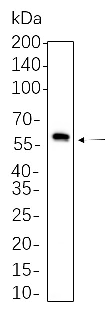 Recombinant SQSTM1/p62 Monoclonal Antibody-searchlist-1