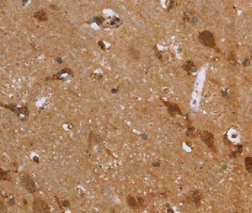 FH Polyclonal Antibody - 3