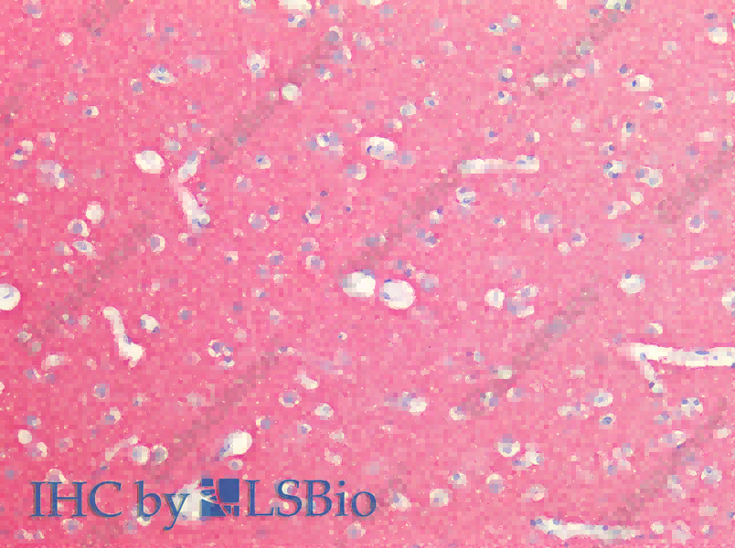 SNAP25 Polyclonal Antibody - 2