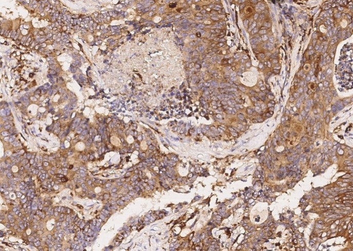 SIAE/sialate O-acetylesterase Monoclonal Antibody - small - 2