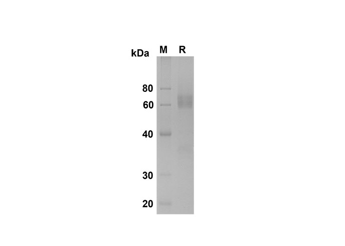 Recombinant Human IL1B Protein(His Tag)-产品推荐-1