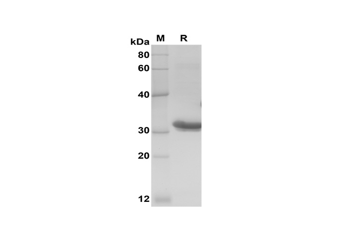 Recombinant Human FGF2 Protein(GST Tag)-产品推荐-1