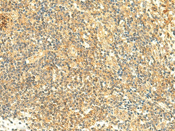 Immunohistochemistry of paraffin-embedded Human tonsil tissue  using ARL4D Polyclonal Antibody at dilution of 1:50(?200)