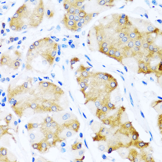 Immunohistochemistry of paraffin-embedded Human stomach using ACVR1C Polyclonal Antibody at dilution of 1:100 (40x lens).