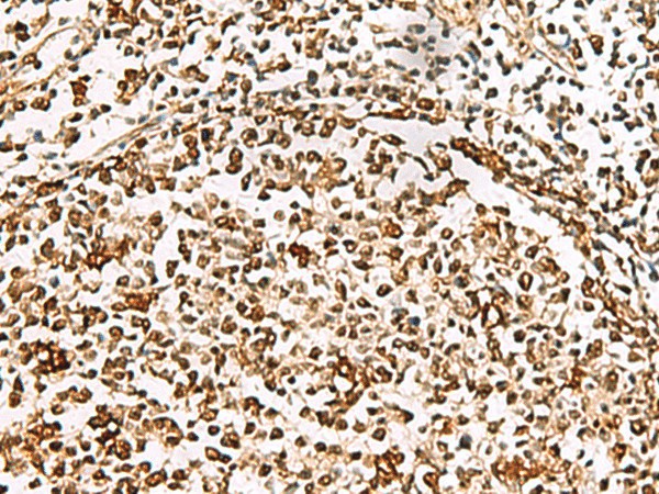 Immunohistochemistry of paraffin-embedded Human tonsil tissue  using XRCC4 Polyclonal Antibody at dilution of 1:60(?200)