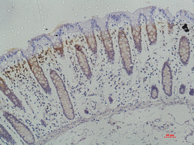 Immunohistochemistry of paraffin-embedded Human colon using Galectin 3 Monoclonal Antibody at dilution of 1:50.