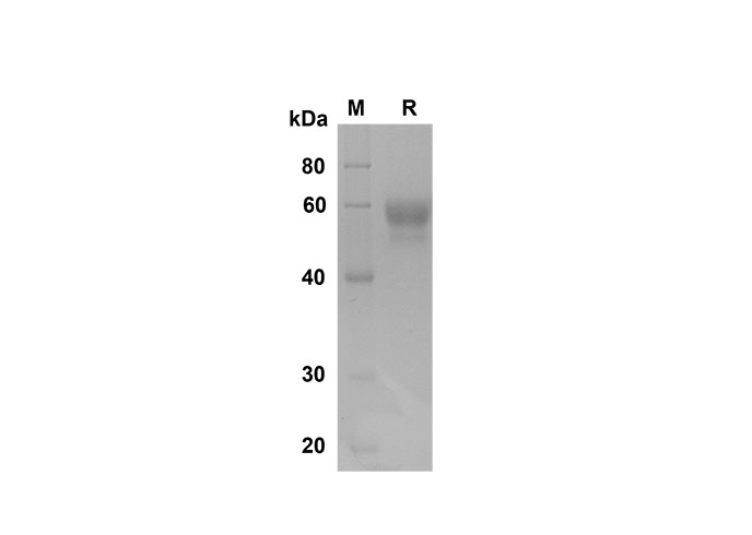 Recombinant Human CD14 Protein(His Tag)-产品推荐-1