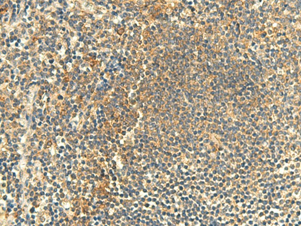 Immunohistochemistry of paraffin-embedded Human tonsil tissue  using CLEC4D Polyclonal Antibody at dilution of 1:50(?200)