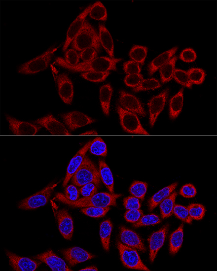 Confocal immunofluorescence analysis of HeLa cells using RRBP1 Polyclonal Antibody at dilution of 1:100. Blue: DAPI for nuclear staining.