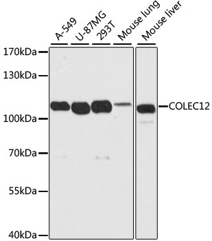 Western blot analysis of extracts of various cell lines using COLEC12 Polyclonal Antibody at dilution of 1:2000.