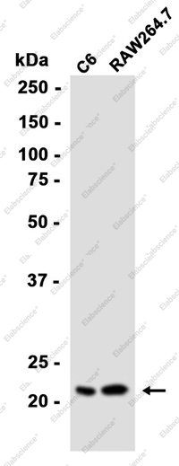 Recombinant Proteasome 20S LMP2 Monoclonal Antibody - 1