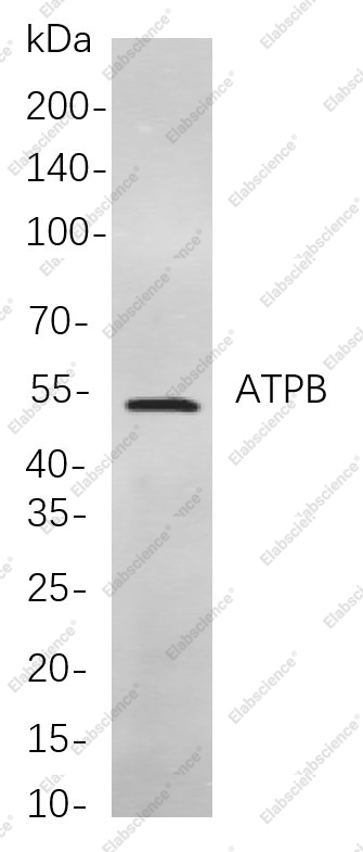 Recombinant ATPB Monoclonal Antibody - 1