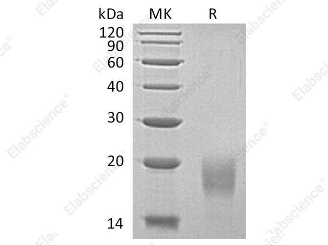 Recombinant Human ALK4/ACVR1B Protein (His Tag) - 1