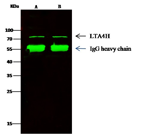 Recombinant Leukotriene A4 Hydrolase/LTA4H Monoclonal Antibody - small - 2