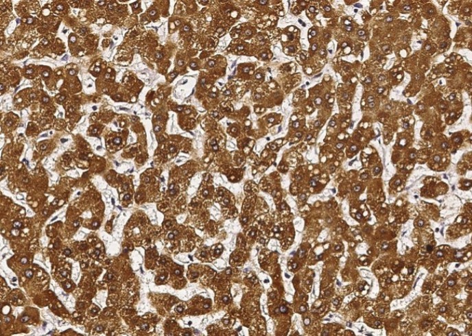 Recombinant SULT1A1 Monoclonal Antibody - small - 2