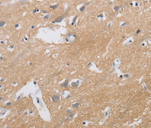 KCNMB3 Polyclonal Antibody - 2