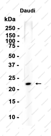 Recombinant HIP2/LIG Monoclonal Antibody - 1