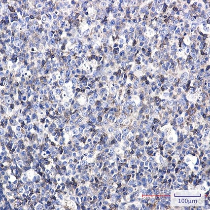Recombinant CD50/ICAM-3 Monoclonal Antibody - 3